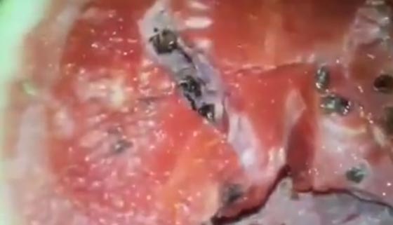 كيف تميز البطيخة المحقونة بالهرمونات؟ فيديو جذب الملايين صورة رقم 2