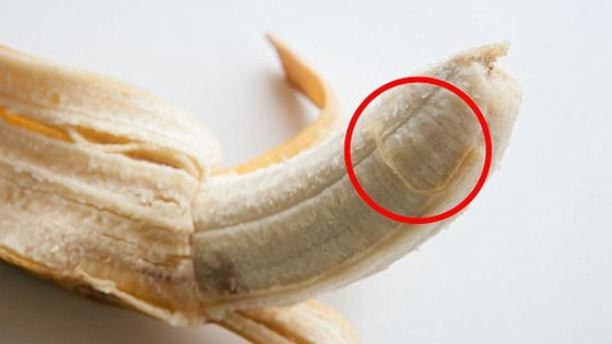 لماذا ينبه الاطباء من ازالة خيوط الموز؟ صورة رقم 1