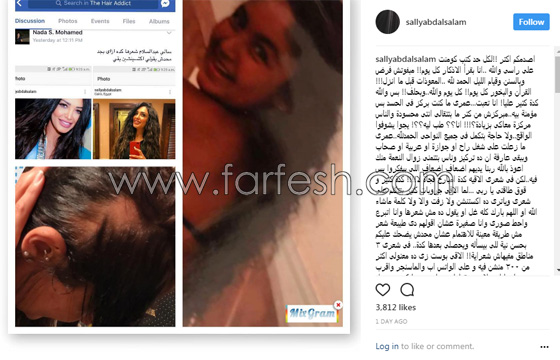 بسبب الحسد والحاسدين: مذيعة مصرية يتساقط شعرها بشكل غريب  صورة رقم 1