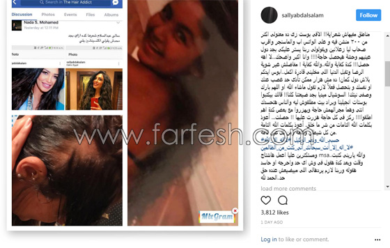 بسبب الحسد والحاسدين: مذيعة مصرية يتساقط شعرها بشكل غريب  صورة رقم 2