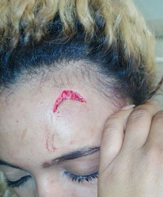 اتهام سيدة زيمبابوي الأولى بالإعتداء على عارضة أزياء بالضرب! صورة رقم 3