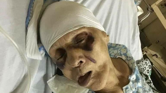 مصري يعذب أمه المسنة حتى الموت لارضاء زوجته.. صور مؤلمة.. صورة رقم 1