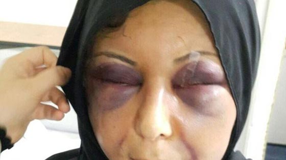 فيديو عنيف: زوج بحالة هستيرية يضرب راس زوجته بالحائط ناويا قتلها.. وهذه هي النتيجة! صورة رقم 3
