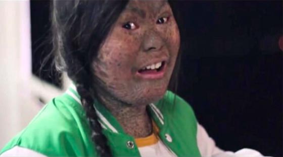 الاعلام الفلبيني يسلط الضوء على الفتاة الافعى للتعرف على معاناتها صورة رقم 1