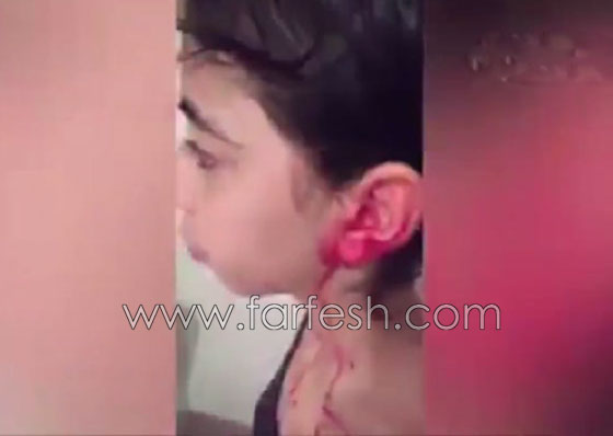فيديو مؤلم.. طفلة مغربية تنزف دما من كل جسدها صورة رقم 2