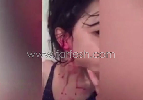 فيديو مؤلم.. طفلة مغربية تنزف دما من كل جسدها صورة رقم 3