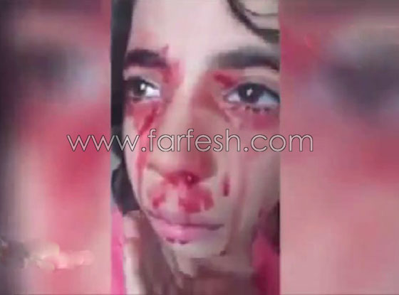فيديو مؤلم.. طفلة مغربية تنزف دما من كل جسدها صورة رقم 4