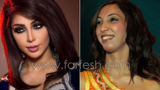 بالصور.. هؤلاء النجمات العرب قبل وبعد عمليات التجميل صورة رقم 2