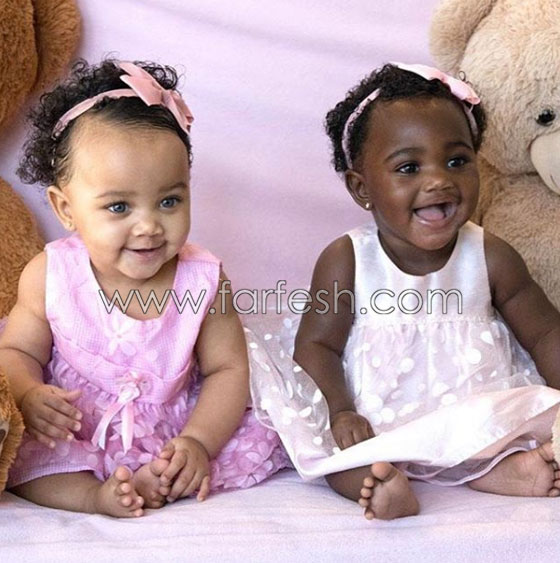  صور توأم أدهش العالم: طفلتان ساحرتا الجمال احداهما سوداء البشرة والأخرى شقراء صورة رقم 1