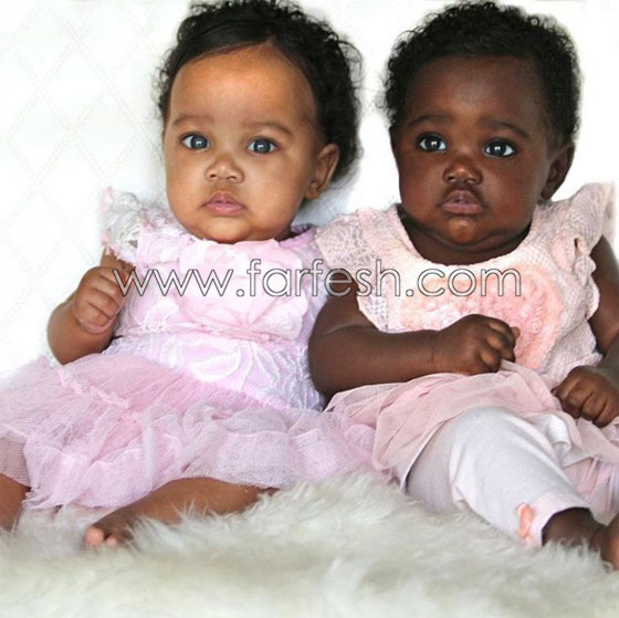  صور توأم أدهش العالم: طفلتان ساحرتا الجمال احداهما سوداء البشرة والأخرى شقراء صورة رقم 2