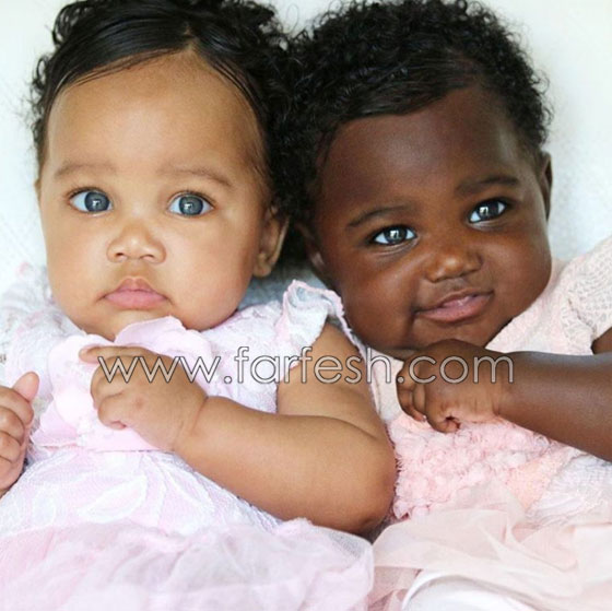  صور توأم أدهش العالم: طفلتان ساحرتا الجمال احداهما سوداء البشرة والأخرى شقراء صورة رقم 3