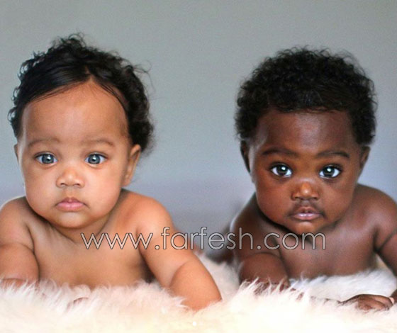  صور توأم أدهش العالم: طفلتان ساحرتا الجمال احداهما سوداء البشرة والأخرى شقراء صورة رقم 4