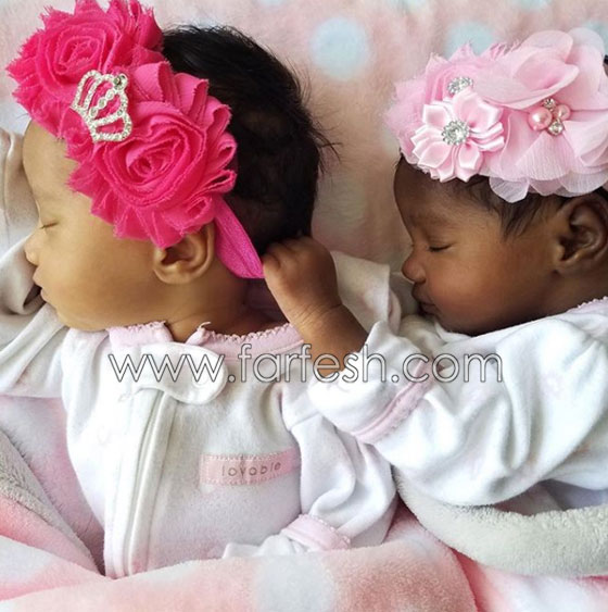 صور توأم أدهش العالم: طفلتان ساحرتا الجمال احداهما سوداء البشرة والأخرى شقراء صورة رقم 5