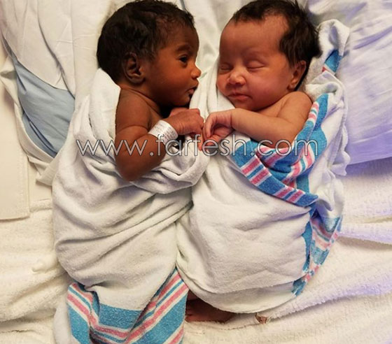  صور توأم أدهش العالم: طفلتان ساحرتا الجمال احداهما سوداء البشرة والأخرى شقراء صورة رقم 6