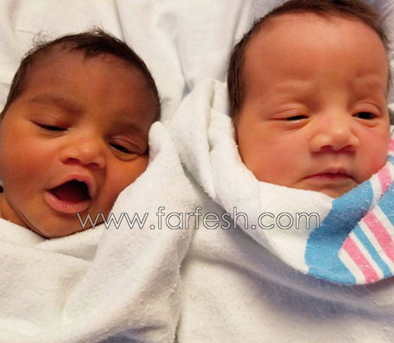  صور توأم أدهش العالم: طفلتان ساحرتا الجمال احداهما سوداء البشرة والأخرى شقراء صورة رقم 7