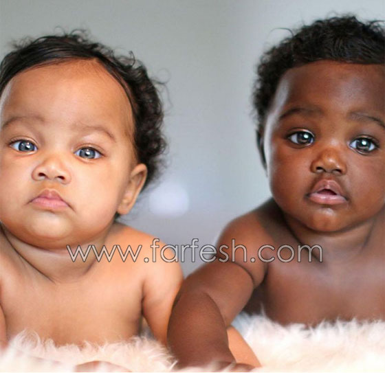  صور توأم أدهش العالم: طفلتان ساحرتا الجمال احداهما سوداء البشرة والأخرى شقراء صورة رقم 9