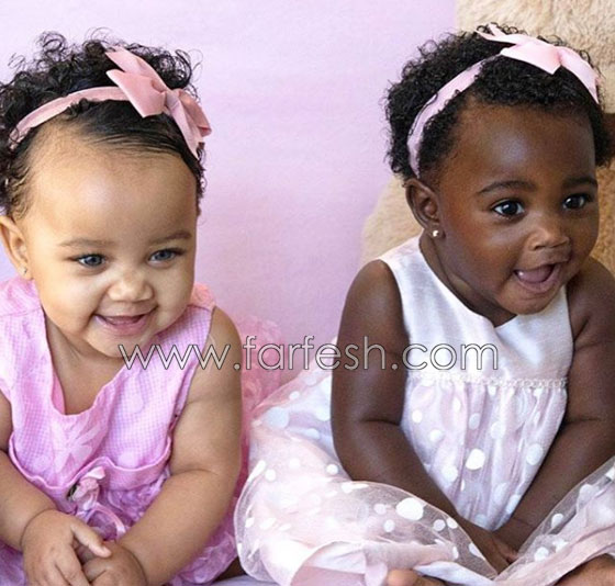  صور توأم أدهش العالم: طفلتان ساحرتا الجمال احداهما سوداء البشرة والأخرى شقراء صورة رقم 10