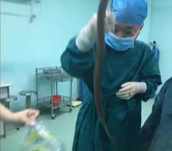 بالفيديو والصور.. استخراج ثعبان بحر من بطن رجل صيني وهو بحالة سكر! صورة رقم 3