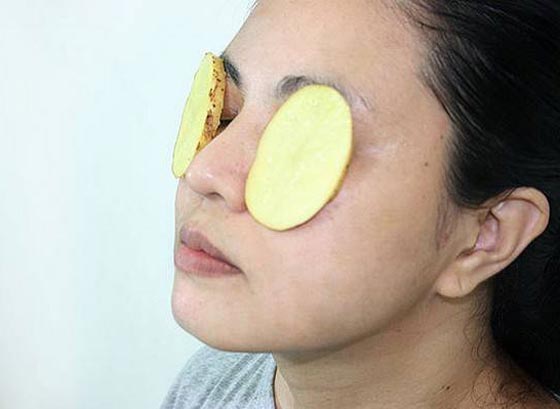 10 طرق مختلفة لاستخدام البطاطس حتى تنعموا ببشرة شابة نضرة  صورة رقم 2