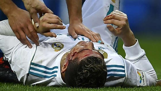 بالصور.. كريستيانو رونالدو تعرض لإصابة قوية غرقت وجهه بالدماء صورة رقم 1
