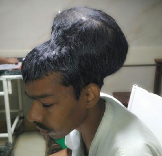 رأسان بواحد.. صور شاب هندي بورم قياسي صورة رقم 1