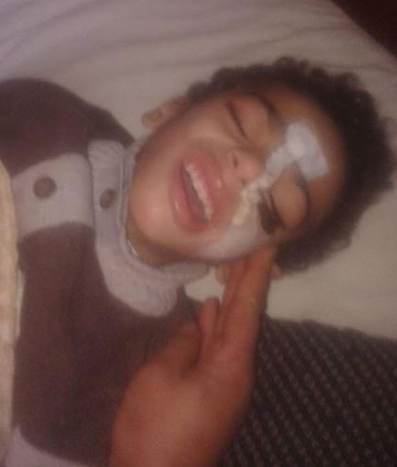 صور طفل مصري يكاد يموت! تحوّل لهيكل عظمي وينتظر رد وزارة الصحةّ! صورة رقم 3