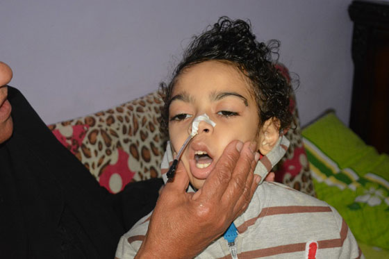 صور طفل مصري يكاد يموت! تحوّل لهيكل عظمي وينتظر رد وزارة الصحةّ! صورة رقم 1