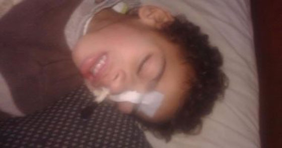 صور طفل مصري يكاد يموت! تحوّل لهيكل عظمي وينتظر رد وزارة الصحةّ! صورة رقم 4