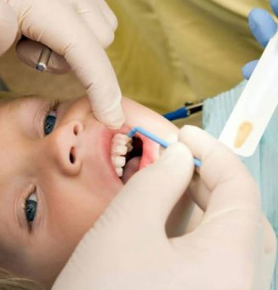 طريقة مذهلة تحمي الأسنان اللبنية لدى الأطفال من التسوس صورة رقم 1