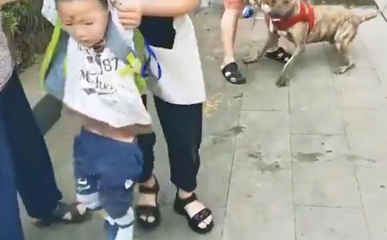 فيديو مرعب.. مارة يقاتلون كلبا لإنقاذ طفل من أنيابه صورة رقم 4