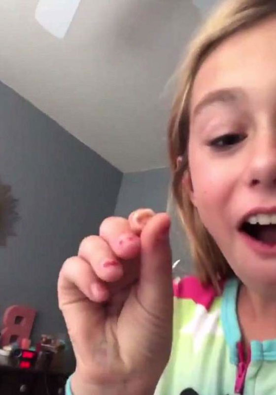 فيديو مدهش..  ببغاء يُساعد طفلة على خلع ضرسها صورة رقم 2