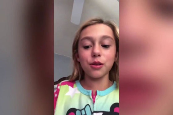 فيديو مدهش..  ببغاء يُساعد طفلة على خلع ضرسها صورة رقم 3