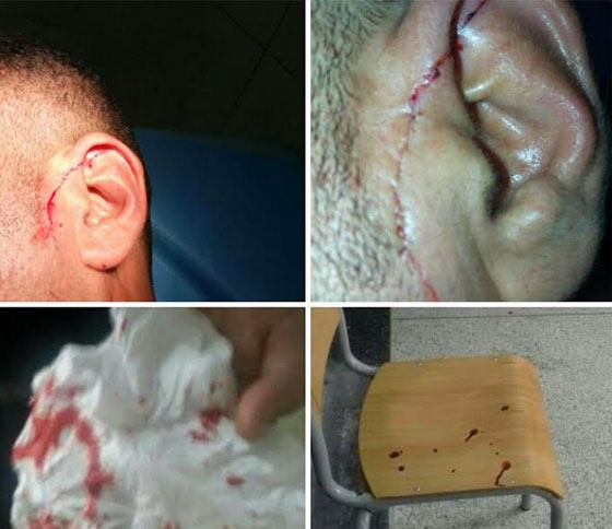 جريمة شنيعة في المغرب: منعه الاستاذ من الغش في الامتحان فطعنه بسكين صورة رقم 1