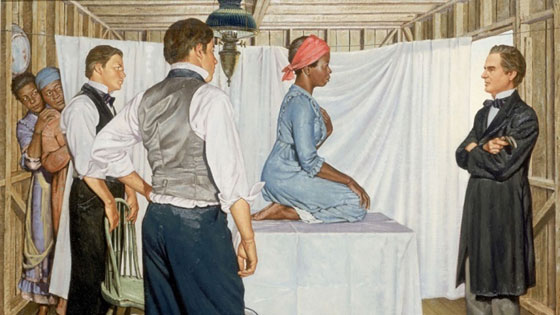 جراحات بلا تخدير وثقب جماجم.. أبشع تجارب الطب ضد النساء السود صورة رقم 1