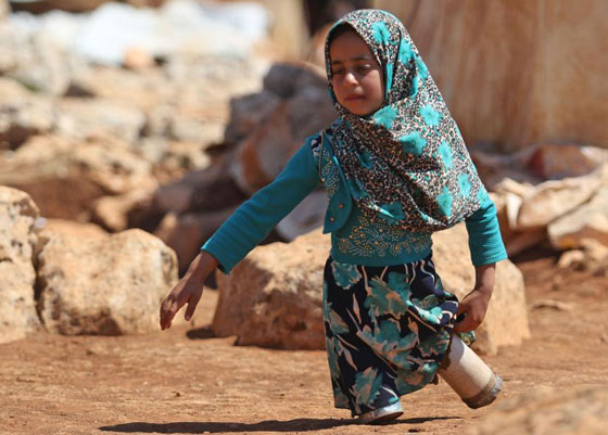 فيديو مبكي: طفلة سورية مبتورة القدمين تنتعل علب معدنية كأطراف! صورة رقم 1