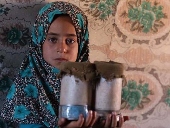 فيديو مبكي: طفلة سورية مبتورة القدمين تنتعل علب معدنية كأطراف! صورة رقم 7