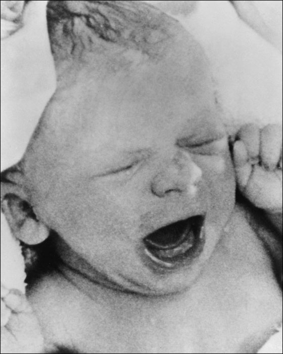 قصة أول طفلة ولدت بالتلقيح الاصطناعي في العالم تحتفل بعيد ميلادها الـ40 صورة رقم 3