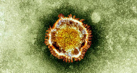 فيروسات خطيرة أرعبت العالم في السنوات الأخيرة صورة رقم 4