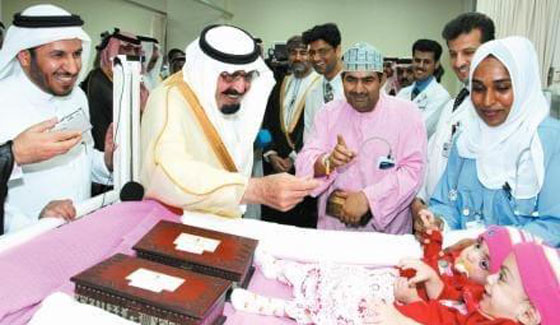 صور  التوأم السيامي العماني صفا ومروة بعد 11 عاما من عملية الفصل  بأمر ملك السعودية صورة رقم 3