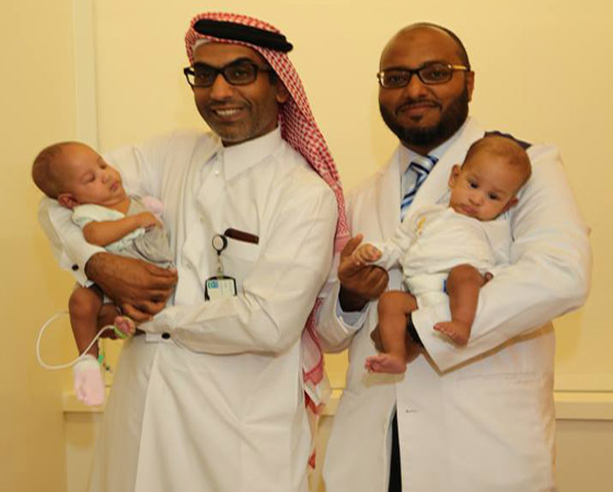 بالفيديو والصور.. نجاح أول عملية جراحية فريدة لفصل توأم ملتصق في قطر صورة رقم 7