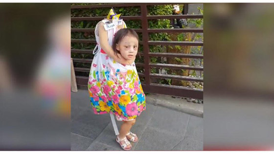 أكثر الفيديوهات رعبًا في الهالوين: طفلة تحمل رأسها بين يديها  صورة رقم 2