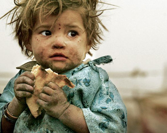  أكثر الدول في العالم تعاني من الجوع صورة رقم 3