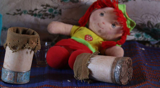 طفلة سورية تستبدل المعلبات الفارغة بأطراف اصطناعية.. اليكم قصتها صورة رقم 11