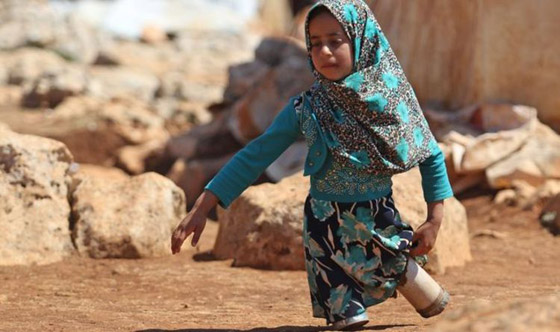 طفلة سورية تستبدل المعلبات الفارغة بأطراف اصطناعية.. اليكم قصتها صورة رقم 8