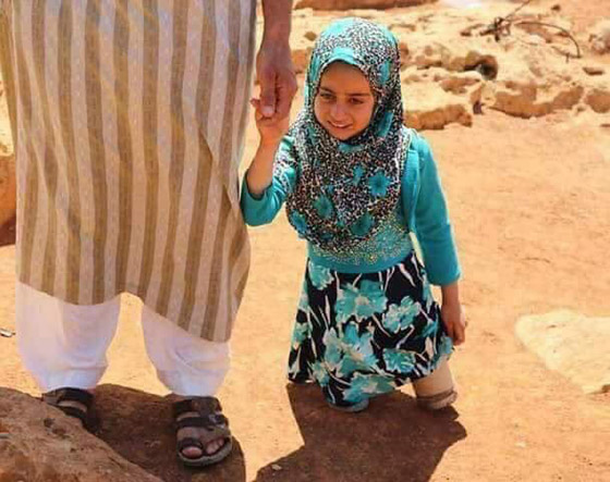 طفلة سورية تستبدل المعلبات الفارغة بأطراف اصطناعية.. اليكم قصتها صورة رقم 5
