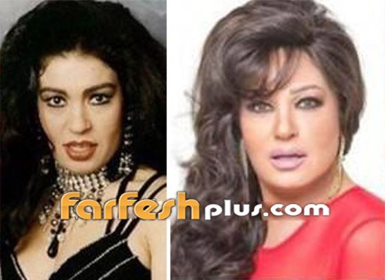 صور 14 فنانة مصرية قبل وبعد عمليات التجميل.. الفرق هائل! صورة رقم 2