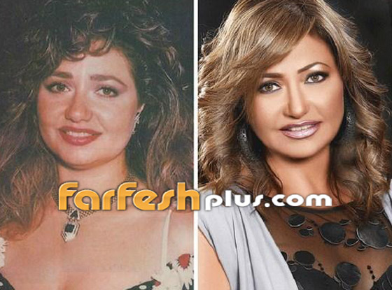 صور 14 فنانة مصرية قبل وبعد عمليات التجميل.. الفرق هائل! صورة رقم 4