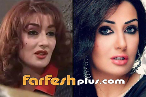 صور 14 فنانة مصرية قبل وبعد عمليات التجميل.. الفرق هائل! صورة رقم 9