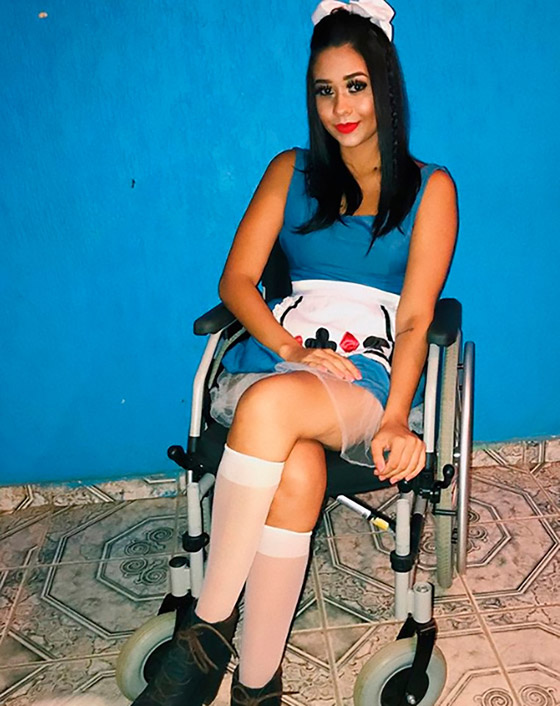 فتاة برازيلية تصاب بالشلل التام بسبب ثقب في الأنف صورة رقم 2