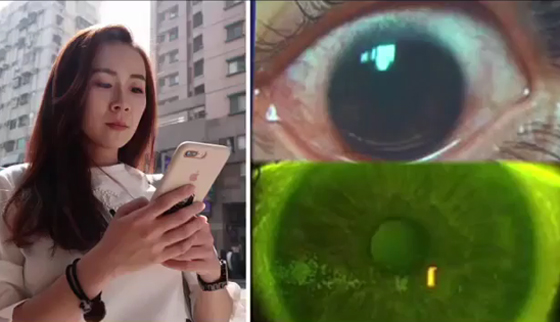 فيديو وصور: سيدة تصاب بـ500 ثقب في قرنية عينها بسبب الموبايل صورة رقم 2